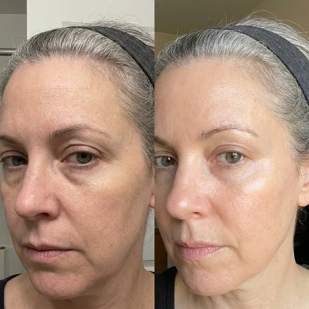 Rebecca T.: a close angled selfie of a woman in a headband twice, her skin brighter and smoother in the second